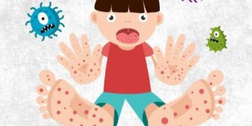 Rinna Suryanti, Soroti Lonjaknya Kasus Campak